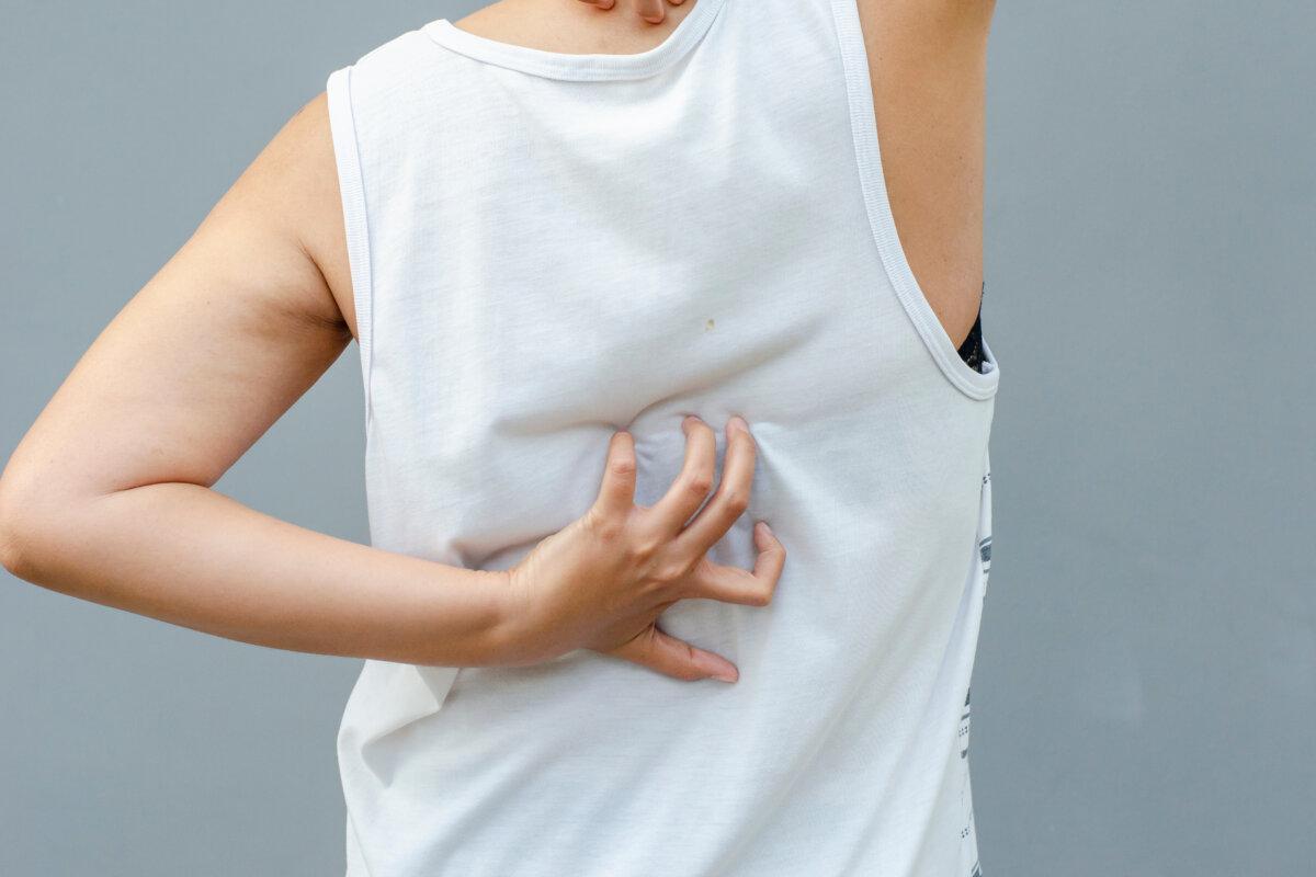 Junge asiatische Frau kratzt Juckreiz mit der Hand am Rückenbereich, Gesundheitskonzept, Dermatose