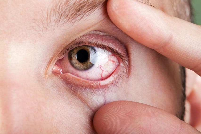 Kapillaren Menschliches Auge