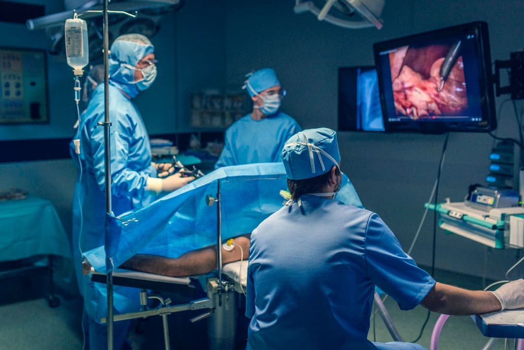 OP-Team bei einer Laparoskopische Chirurgie