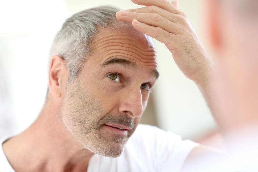 Mann schaut in den Spiegel wegen Haarausfall