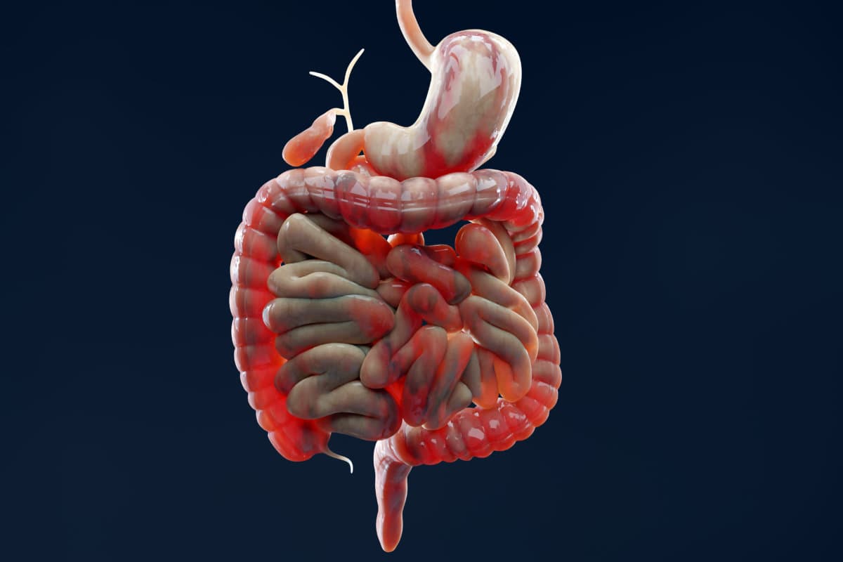 man suffering from crohns disease, male anatomy, inflamed large intestine, Sigmoid Colon, human digestive system parts, 3d render
