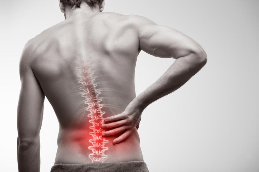 Ein männlicher Rücken mit Rückenschmerzen
