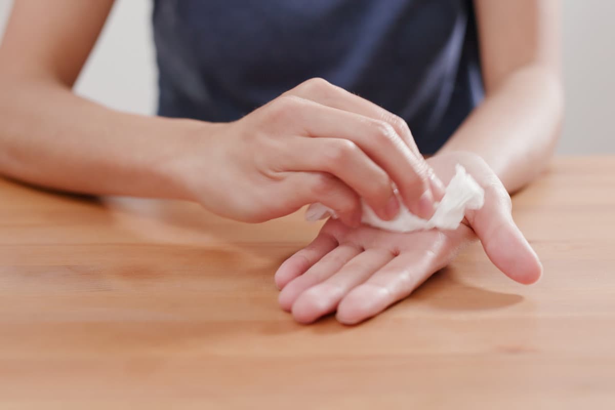 Woman suffer from hand perspiration