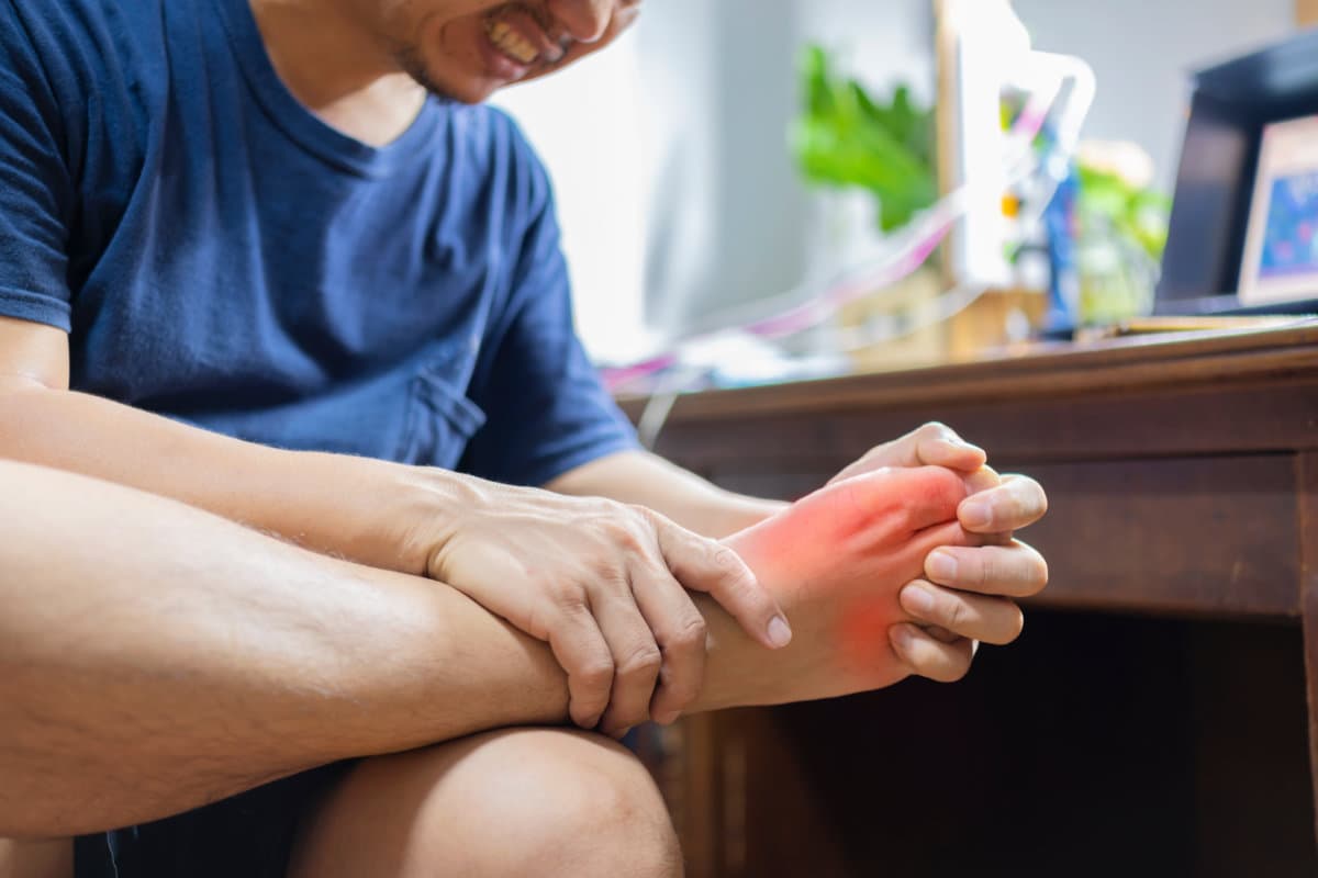 Man with painful and inflamed gout on his foot around the big toe area.