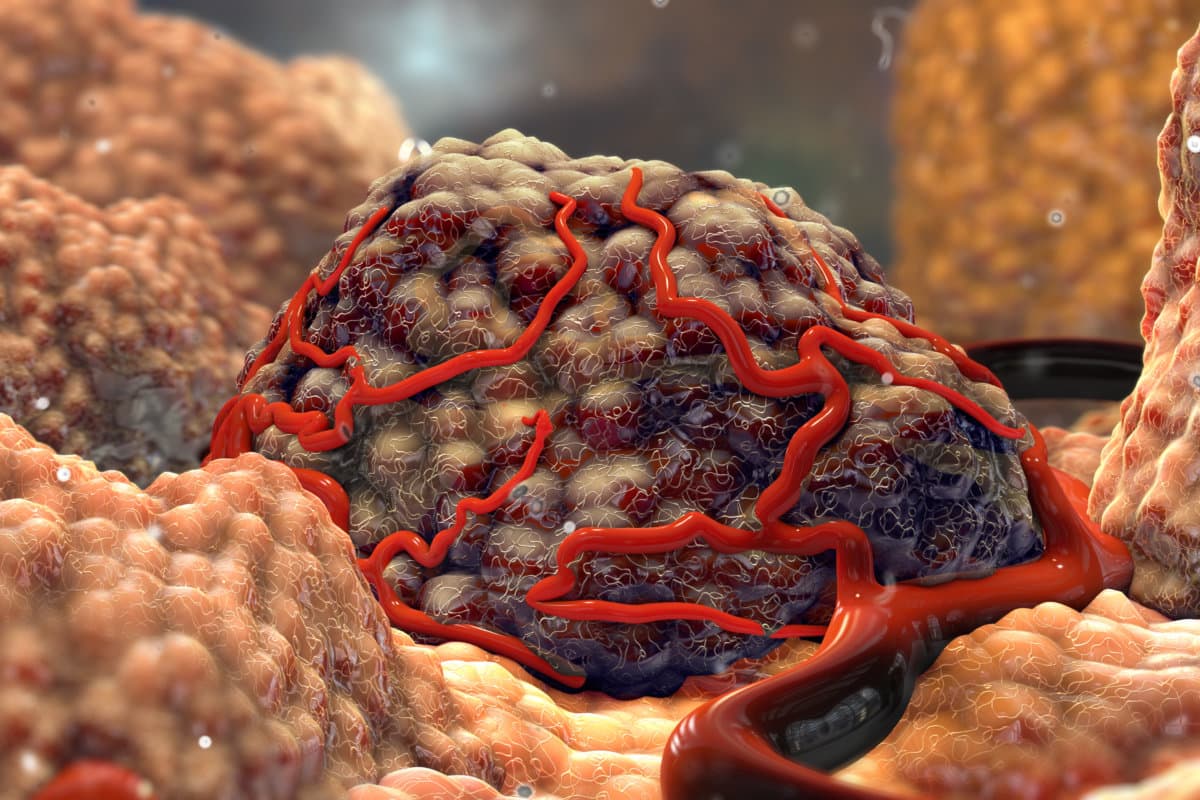 3D Tumor Cancer Cells