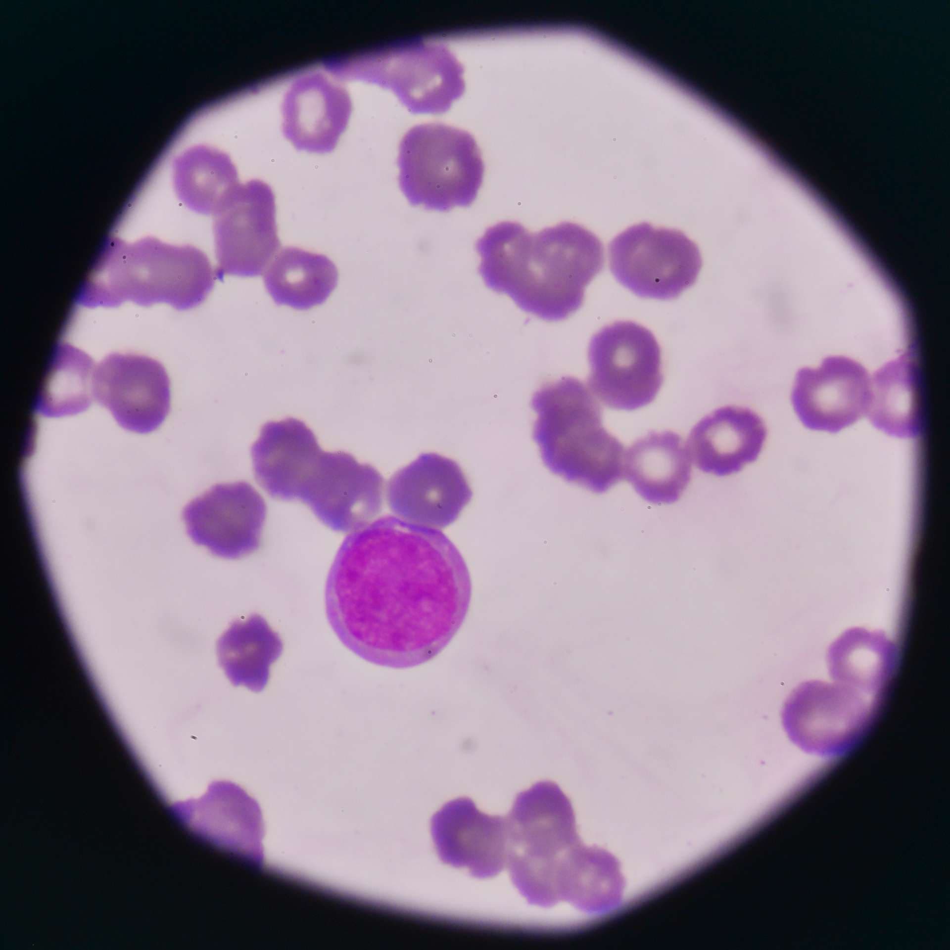 White blood cells Blast cell on red blood cells background.