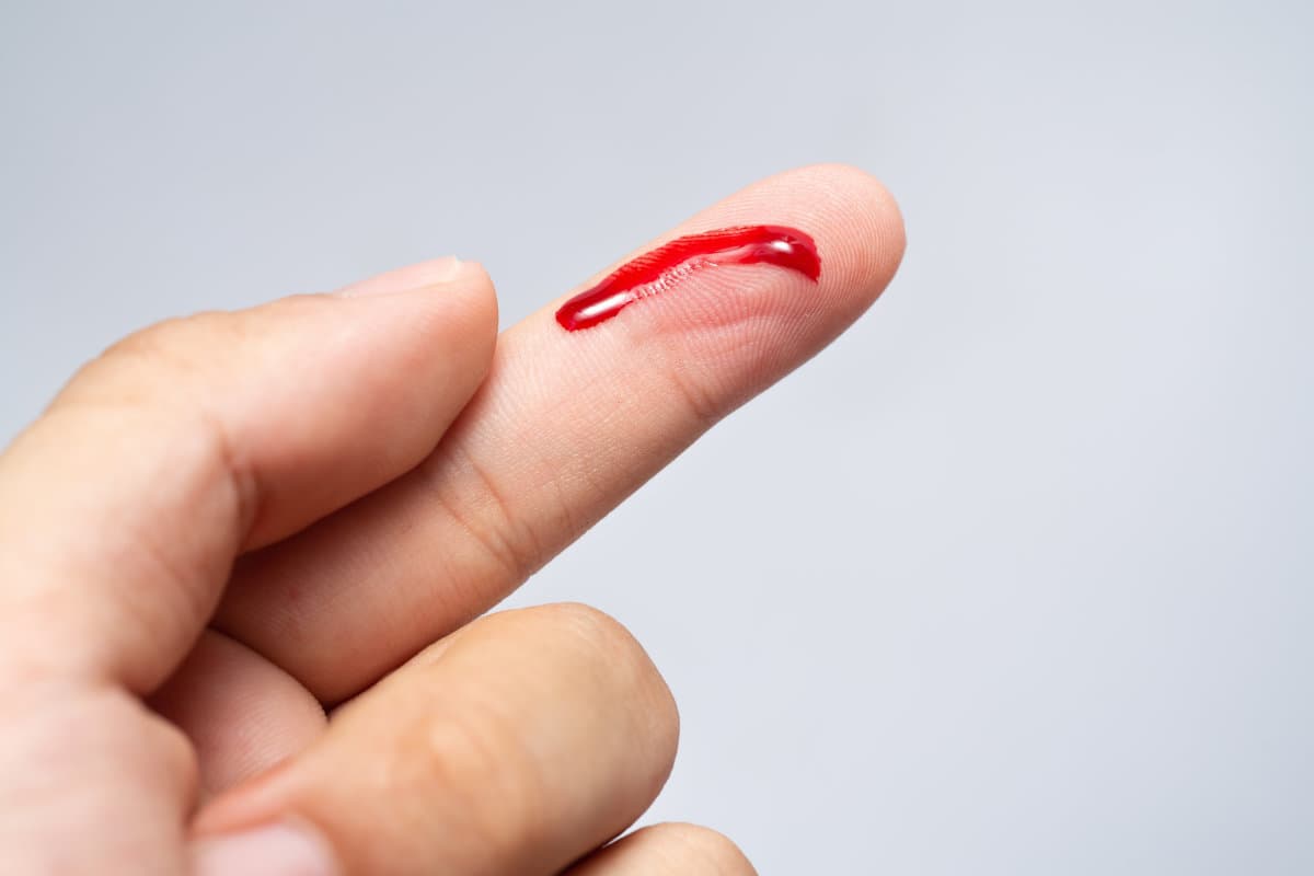 Bleeding blood from the cut finger wound. Injured finger with bleeding open cut wound. Closeup of finger human hand is cut hurt bleeding with bright red blood.