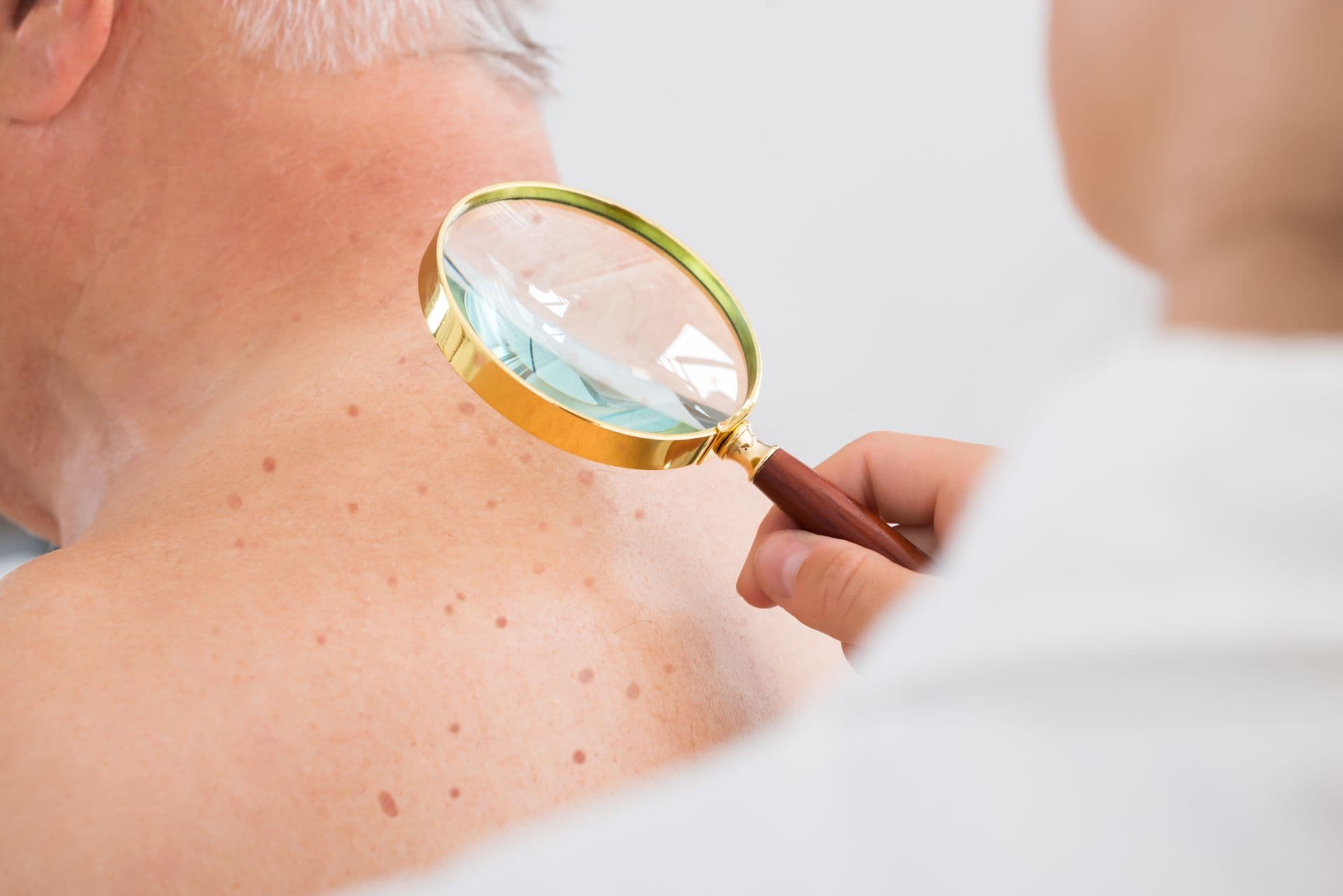 Doctor Checking Skin Of Patient With Magnifying Glass