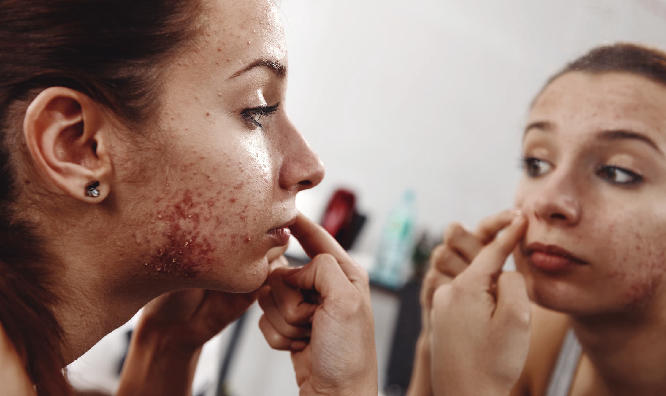 skin problems