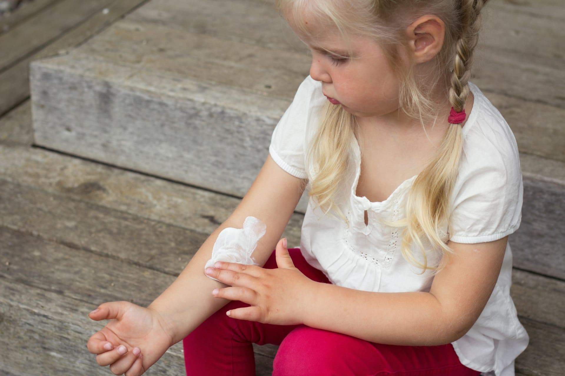 Girl applying dermatology cream on skin