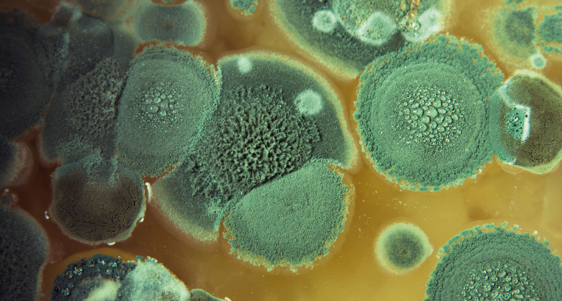Pulmonale invasive Mykosen