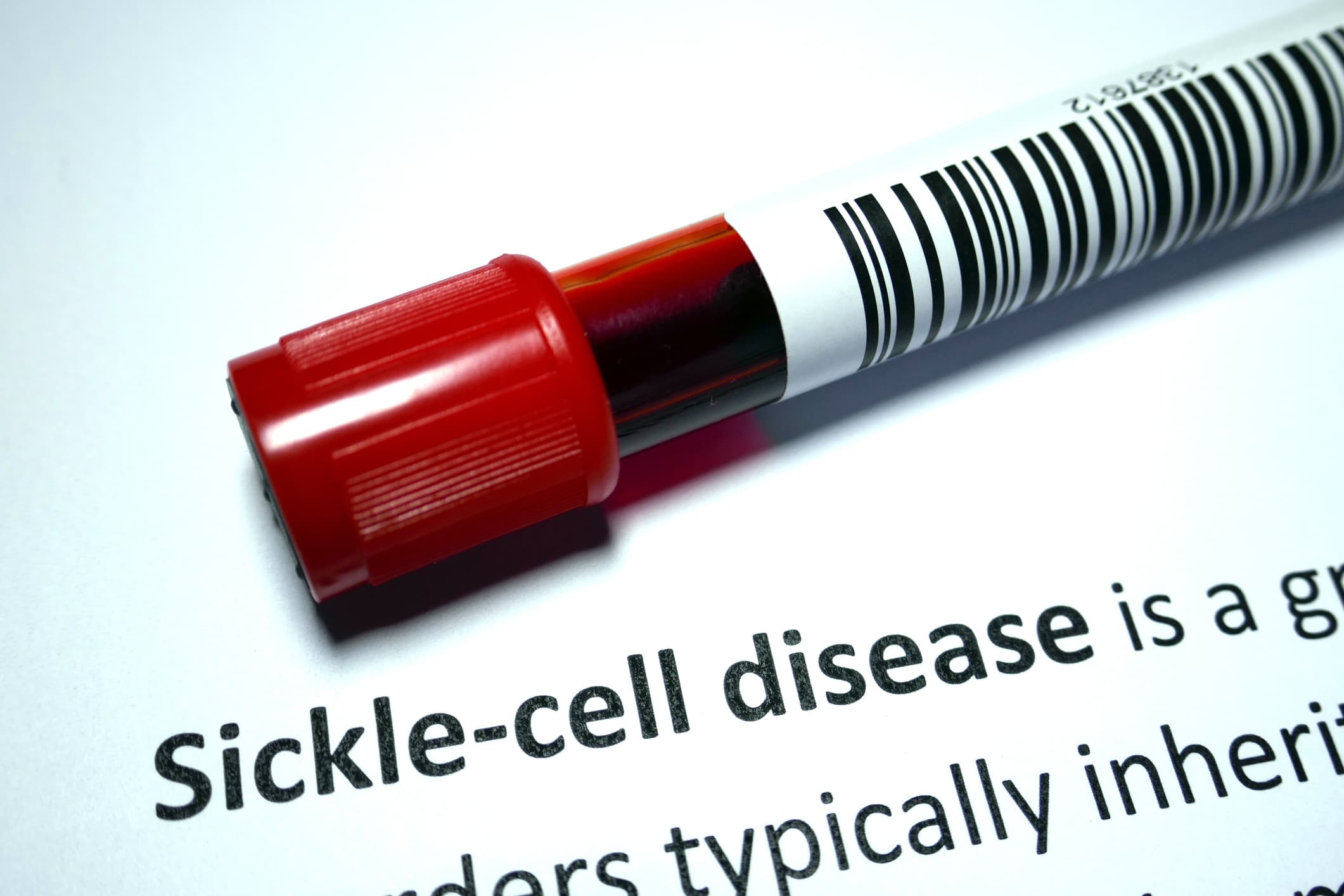 Sickle cell anemia