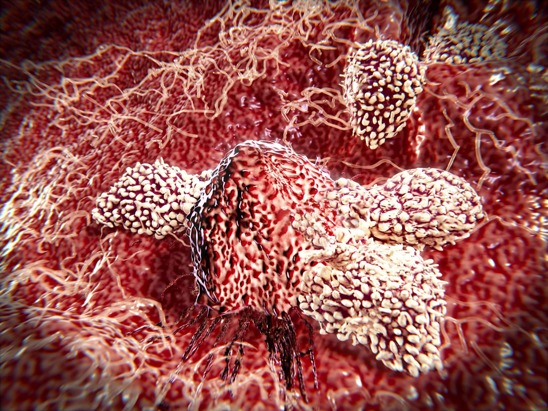 Natural killer cells are a type of lymphocytes which destroy cancer cells and other altered cells releasing cytotoxic granules.