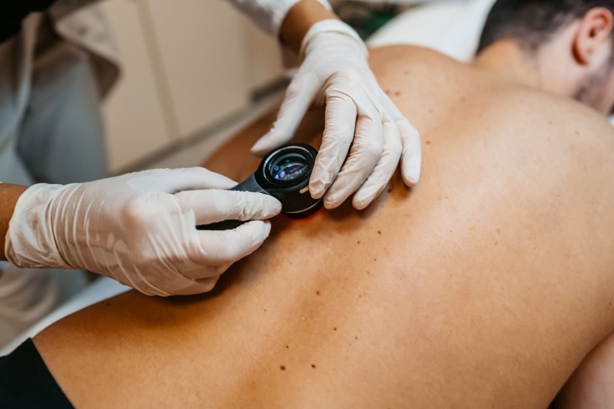 Ärztin untersucht Muttermale von Patienten auf Hautkrebs in einer medizinischen Klinik.