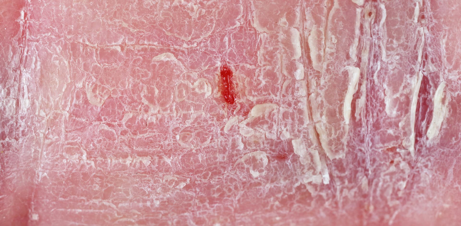 Foto: vavlt/GettyImages