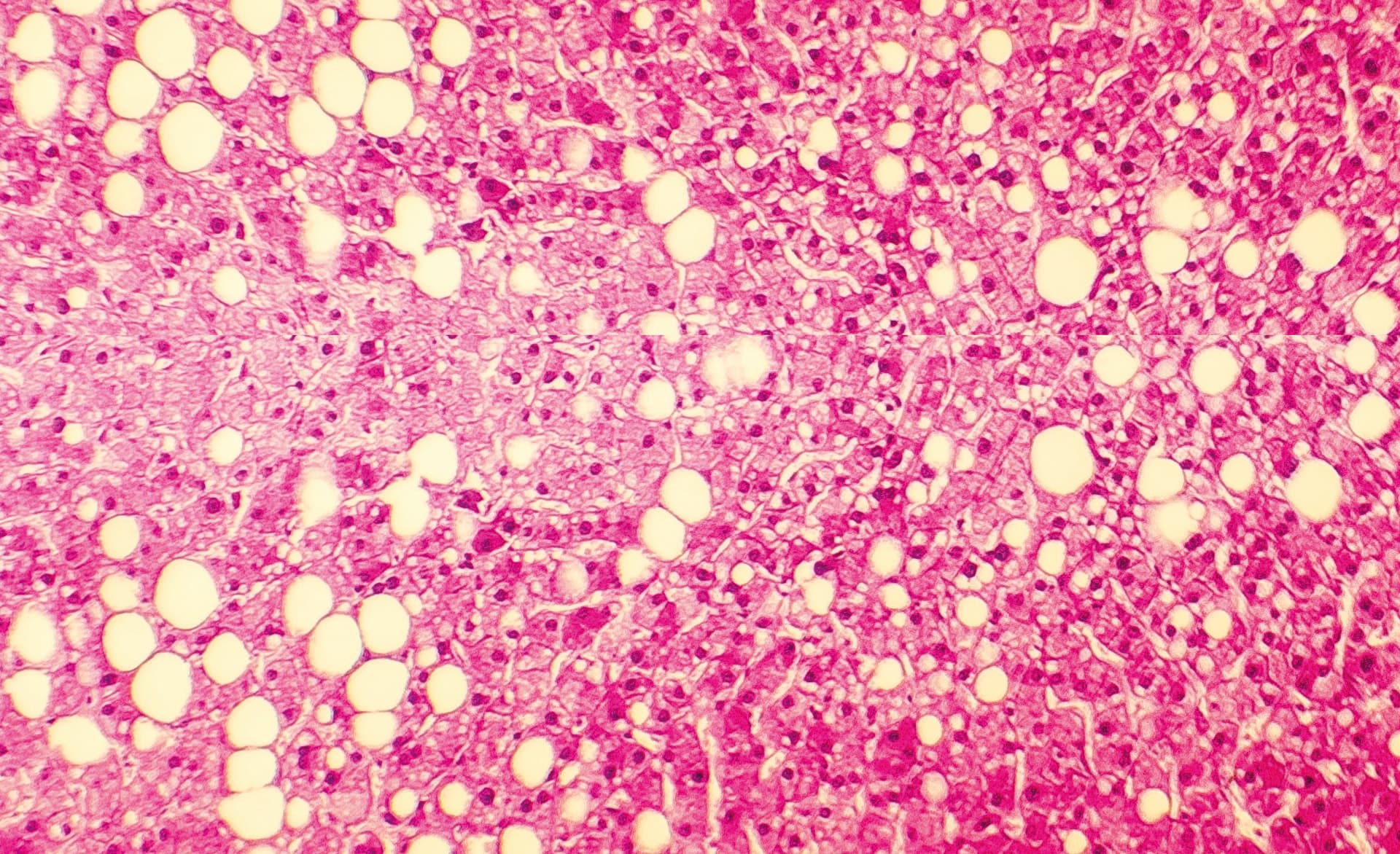 Foto: Dr_Microbe/GettyImages