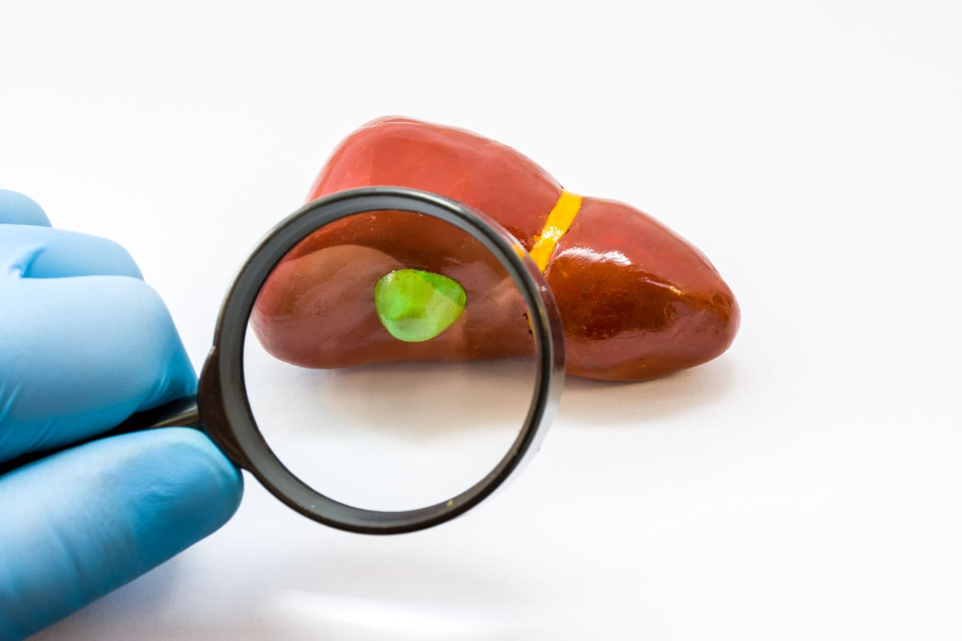 Diagnose der Gallenblase bei Vorliegen einer Krankheit. Doktor Hand in Hand mit Lupengallenblase auf anatomischem Lebermodell auf weißem Hintergrund untersuchen. Konzept für Chirurgie und Gastroenterologie