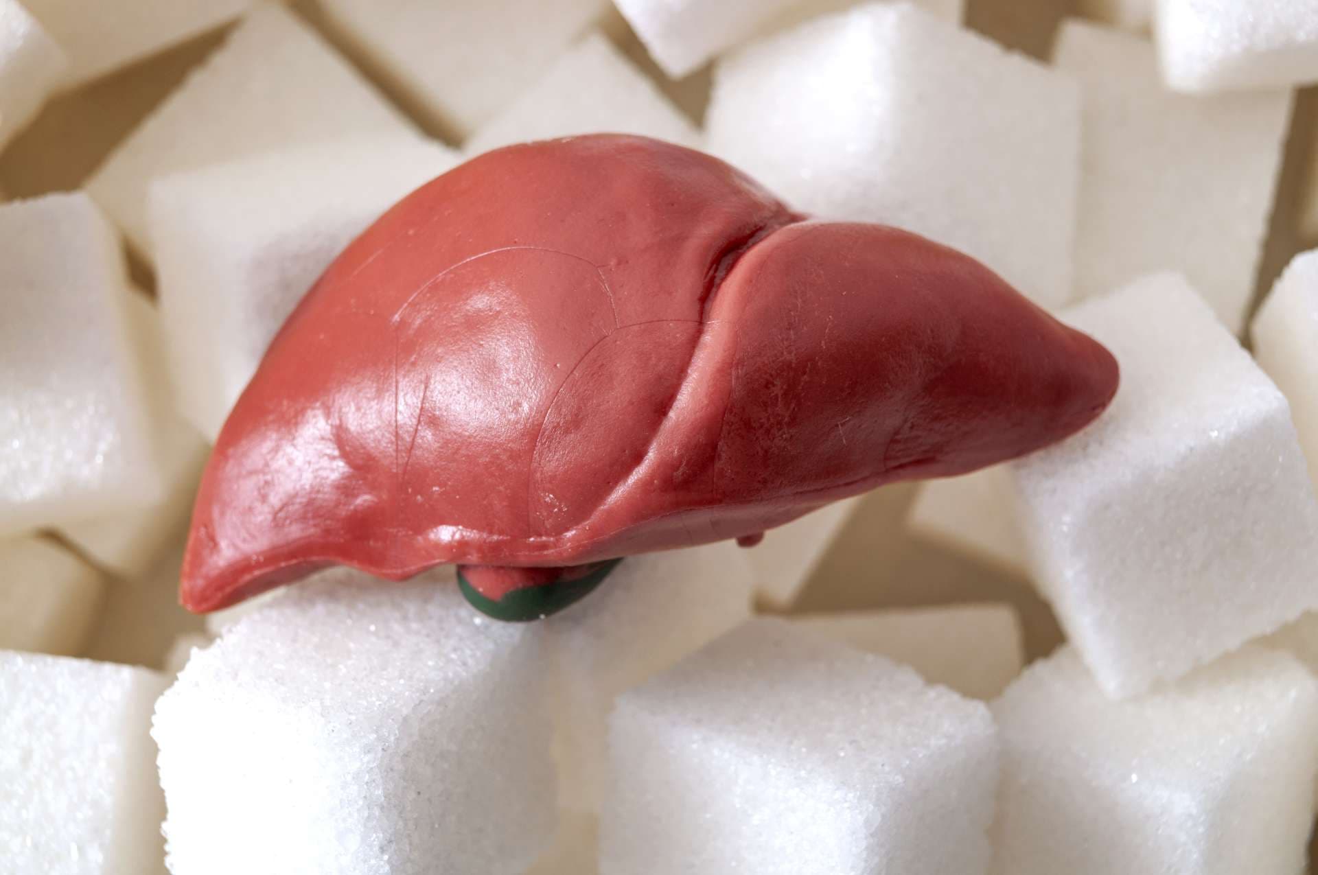 Bad died and nonalcoholic fatty liver disease concept with a liver and sugar cubes, nafld is caused by high levels of fructose accumulated in the liver that can lead to cirrhosis and diabetes