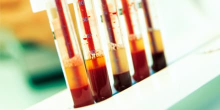Blut_think_87339371_05