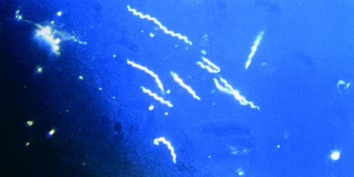Borrelia_burgdorferi_wikimedia_CDC