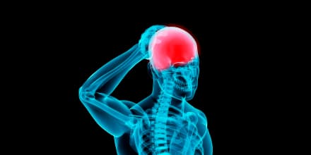 headache illustration