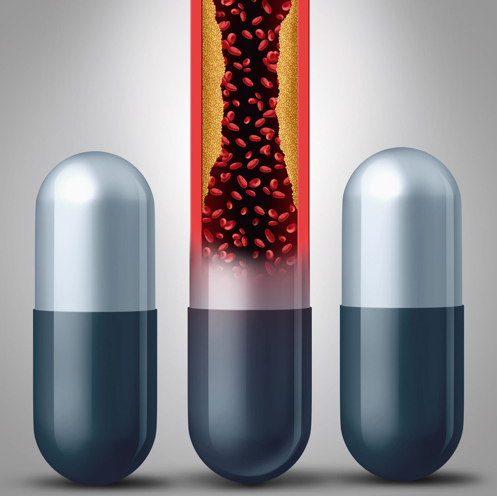 Lipid; Illustration