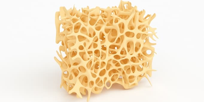 Osteoporose_01