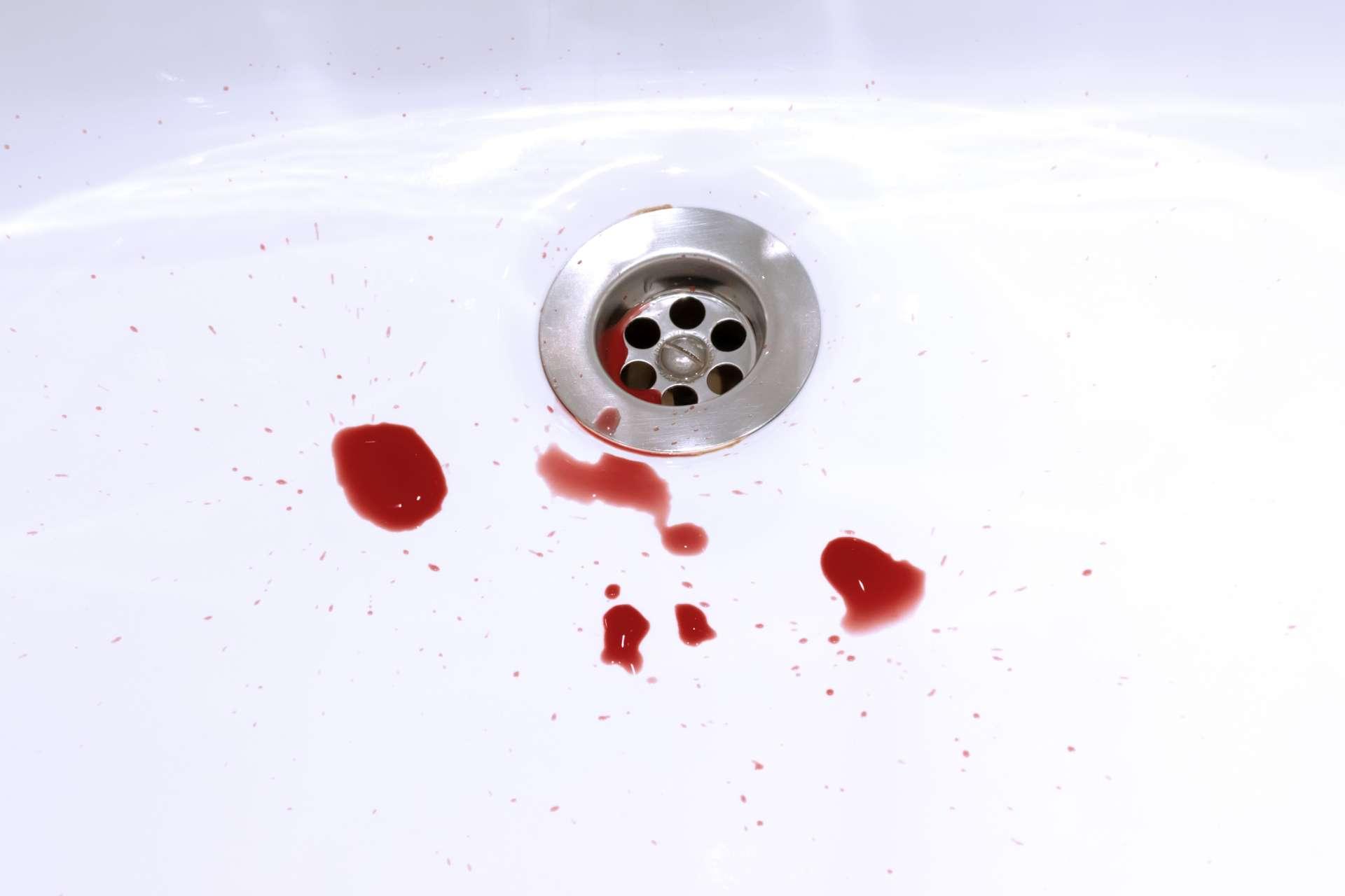 Blutflecken im Waschbecken, Blutungen, Kriminelle und Selbstmordkonzept.