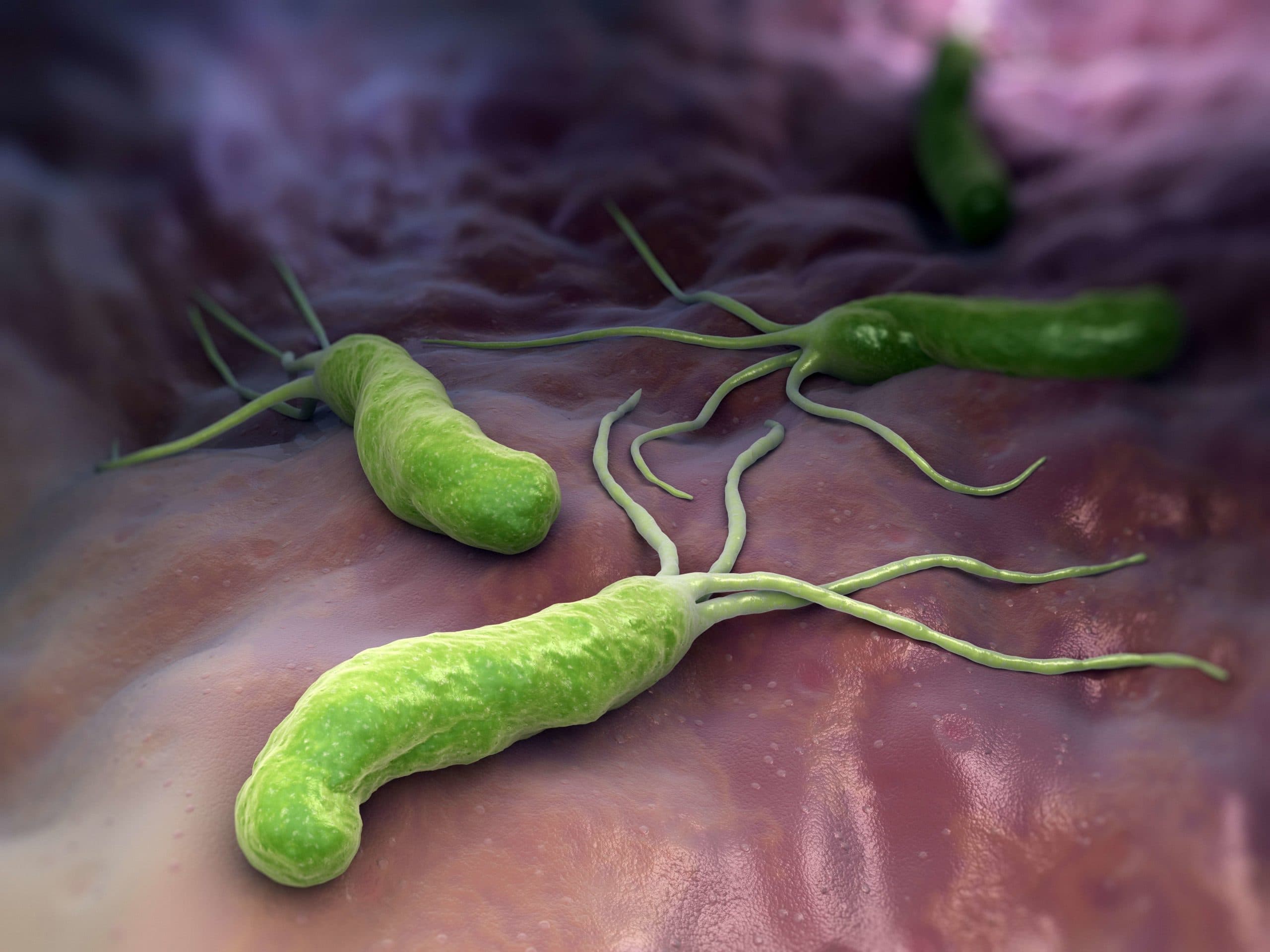 HELICOBACTER PYLORI ist ein gramnegatives, mikroaerophiles Bakterium im Magen