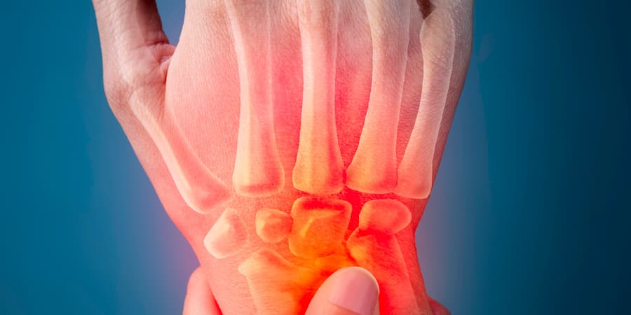 Rheumatoide Arthritis