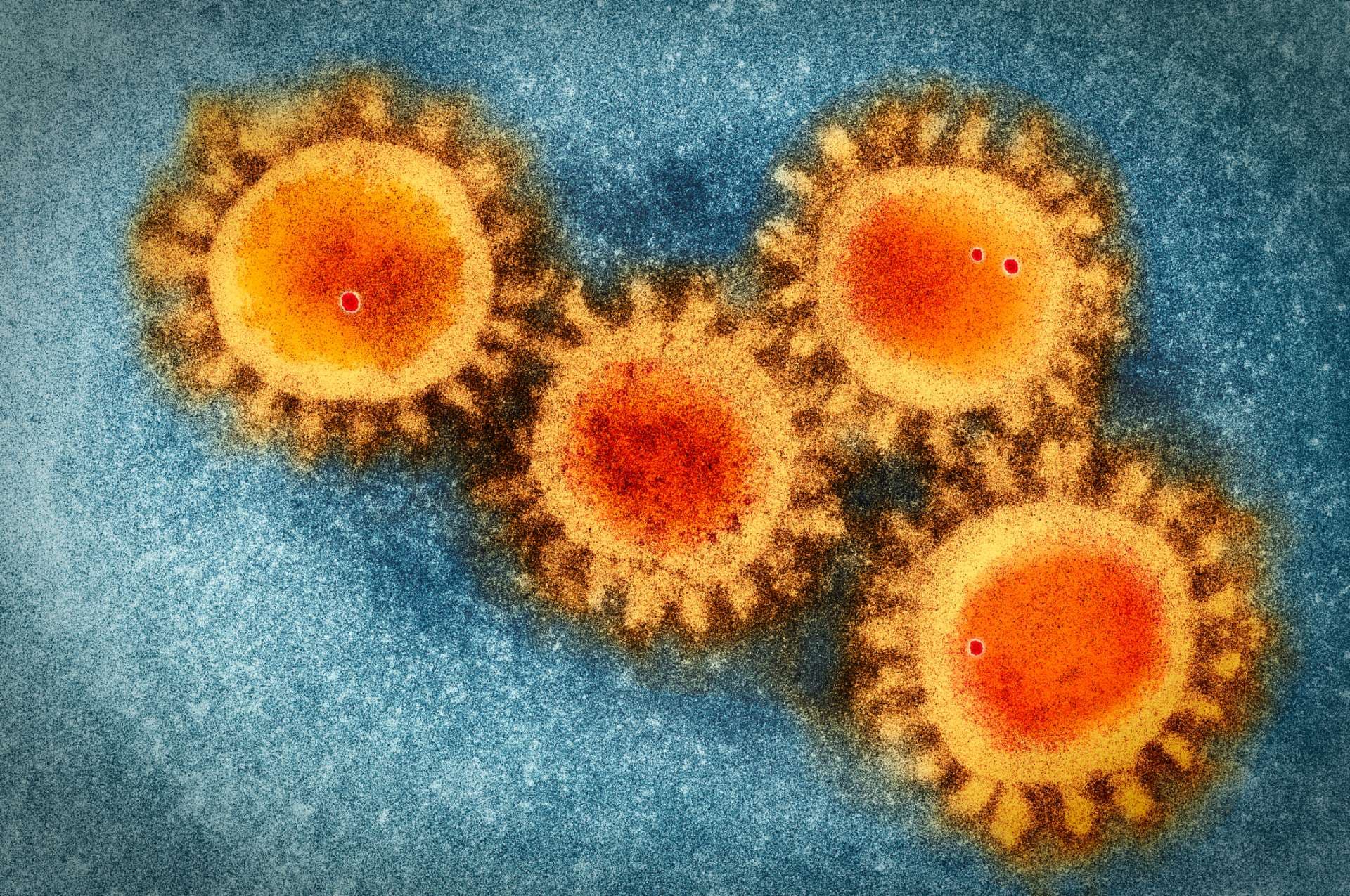 Colored visualisation of electron microscopy photo of the coronavirus  COVID-19