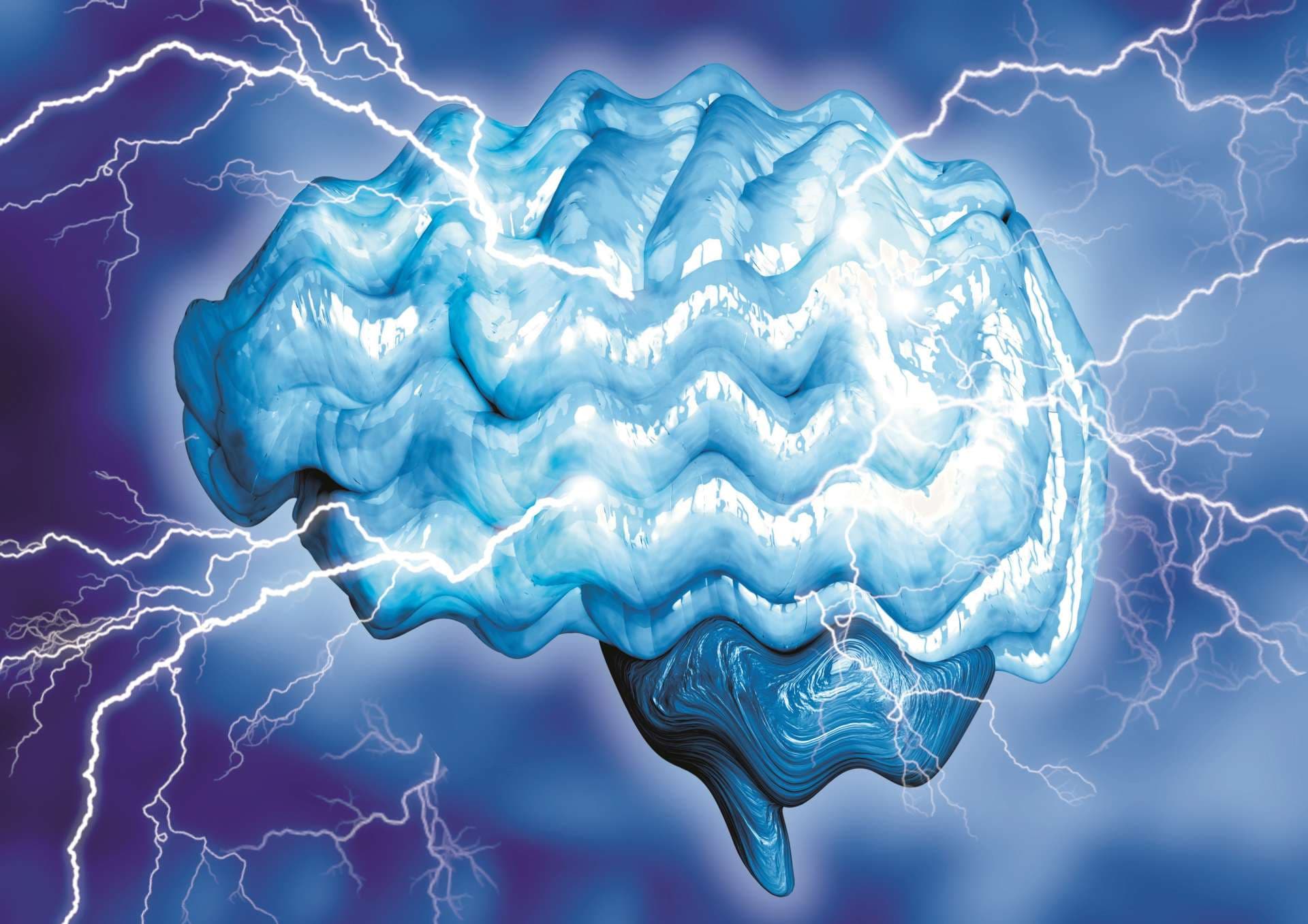 Epilepsy is a chronic brain disease caused by increased electrical activity of neurons. It manifests through involuntary convulsions and momentary loss of consciousness. 3D rendering