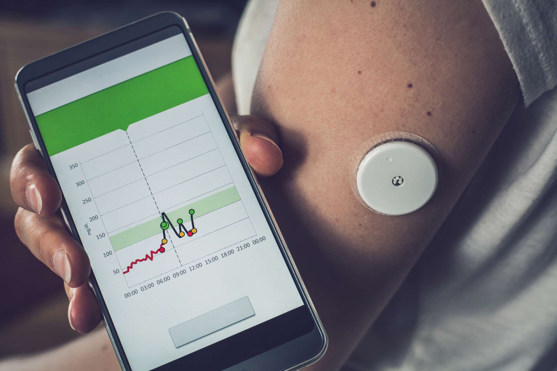 Frau, die Glukosespiegel mit einem entfernten Sensor und Mobiltelefon prüft, Sensor, der Glukosespiegel ohne Blut überprüft. Diabetes-Behandlung.