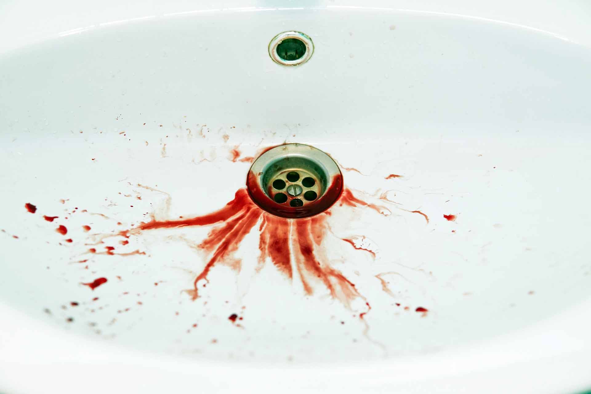 Red floods of blood dripple to the white washbasin drain. Bathroom sink is soiled with blood stains. Unhealthy state. Bleeding human has spitted into washbowl. Fatal outcome. Painful illness