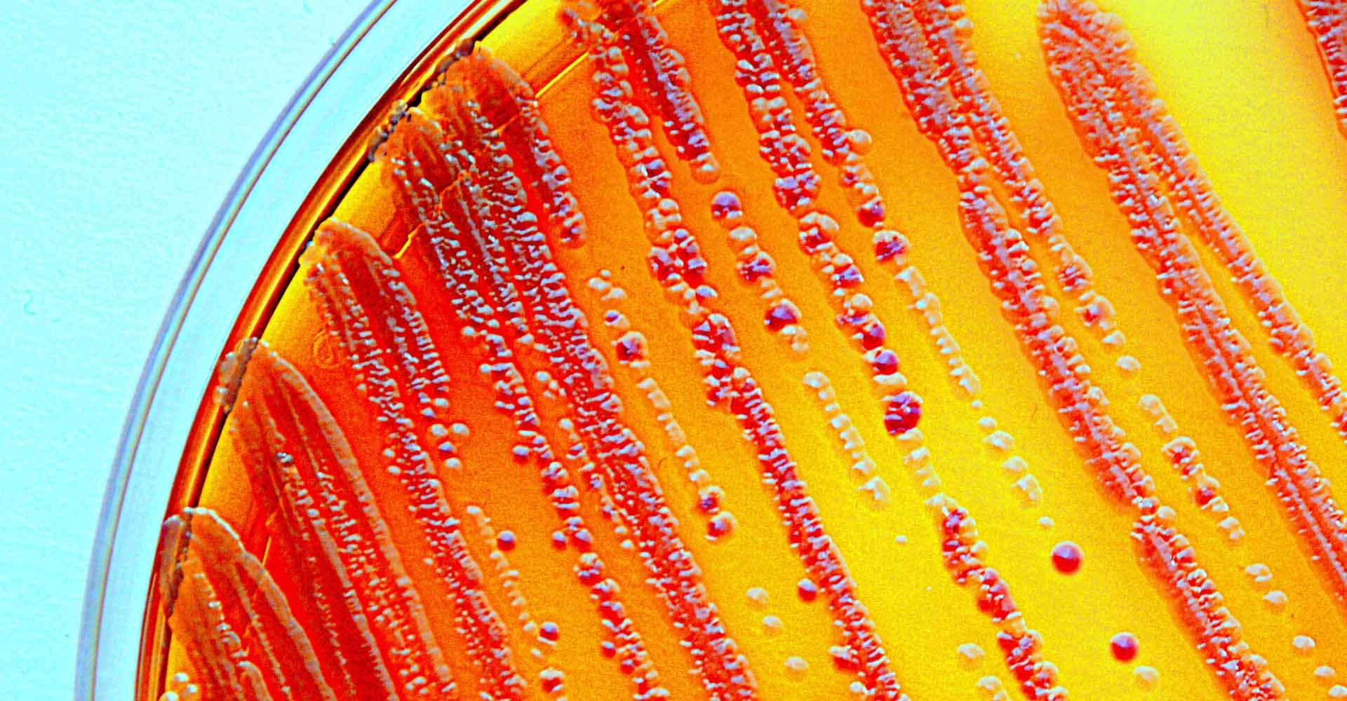 Enterobacteria grown on a selective agar plate. Part of the commensal microbion.