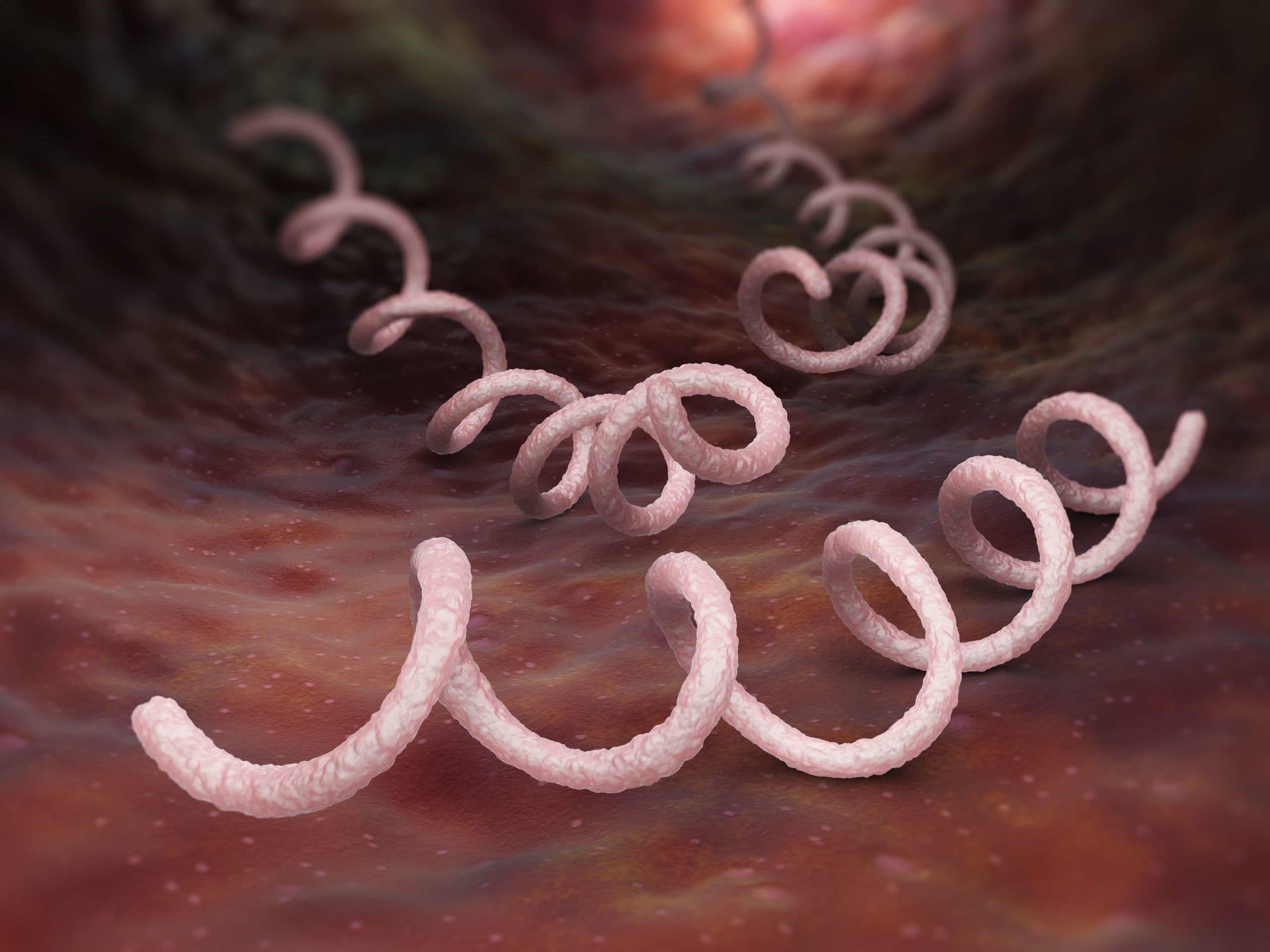 Syphilis ist eine sexuell übertragbare Infektion, die durch das Spirochätenbakterium verursacht wird