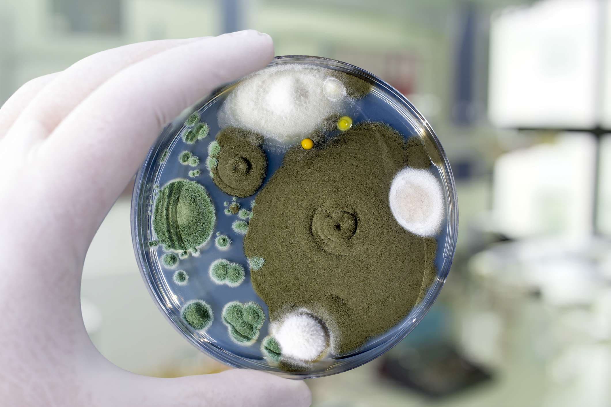 Kolonien verschiedener Schimmelpilze aus der Raumluft auf Petrischale mit Sabourad-Dextrose-Agar, Nahaufnahme. Hand in weißem Handschuh hält Platte mit Mikroben im Forschungslabor