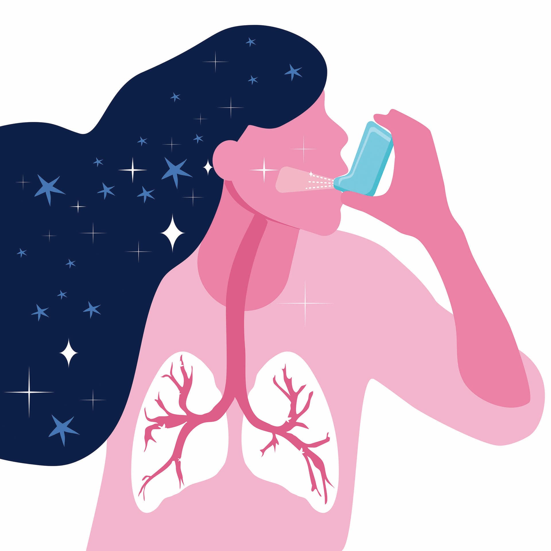Asthma bronchiale. Vektor