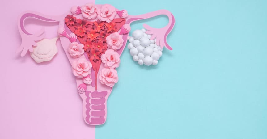 Konzept polyzystisches Ovarialsyndrom, PCOS. Kopieren Sie Raum, Frauen Fortpflanzungssystem