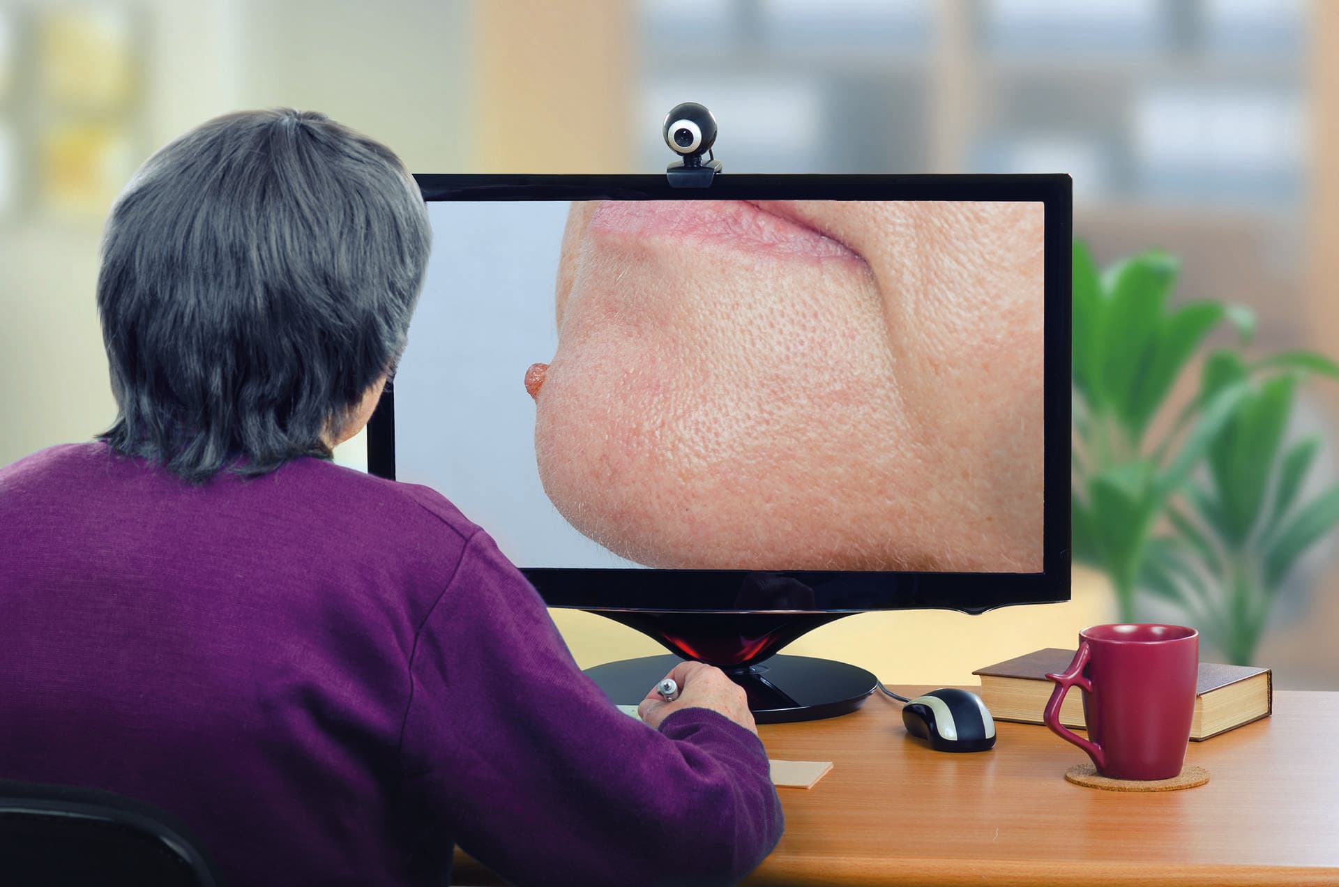 Telemedizin-Dermatologe untersucht Maulwurf am Kinn