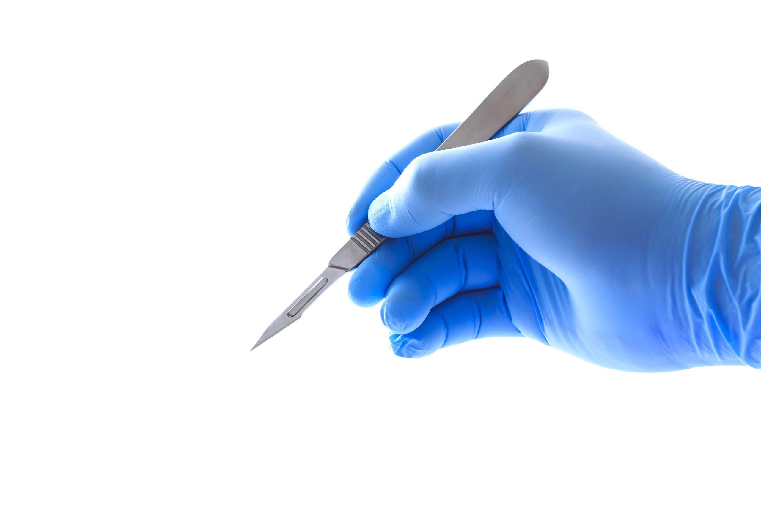 Arzthand hält ein Skalpell mit Beschneidungspfad