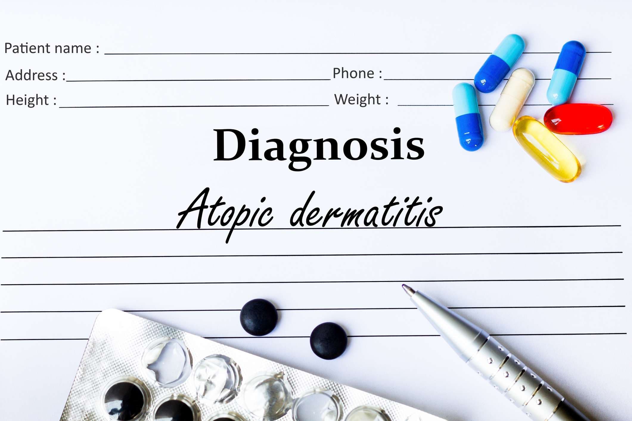 Neurodermitis auf der Diagnoseliste