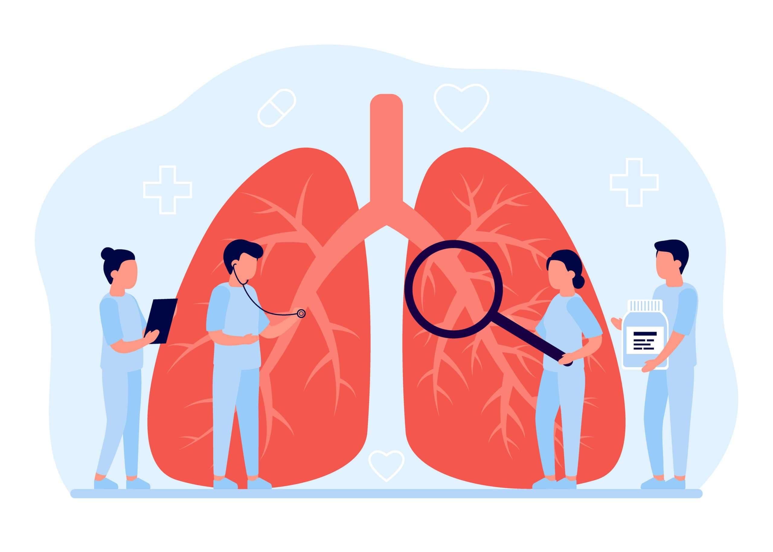 Lungendiagnostik im Gesundheitswesen. Konzept der Lungenkrankheit, Pneumologie, Krebs, Lungenentzündung, Tuberkulose. Interne Organinspektion überprüfen Ärzte. Untersuchung und Behandlung des Atmungssystems. Vektor