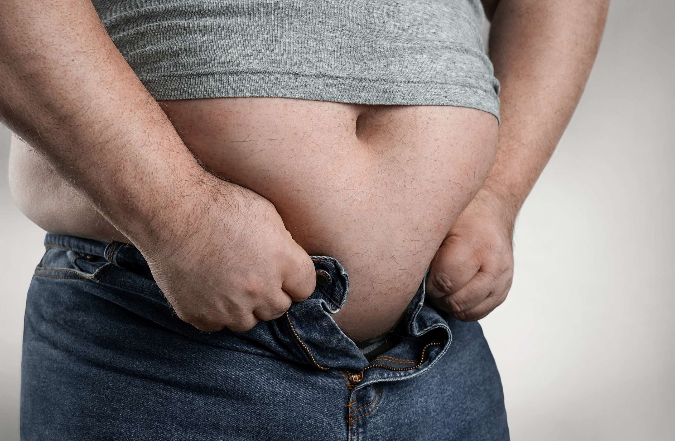 Fettleibigkeitskonzept, Nahaufnahme eines übergewichtigen Mannes, der versucht, zu kleine Jeans mit Kopierraum zu tragen