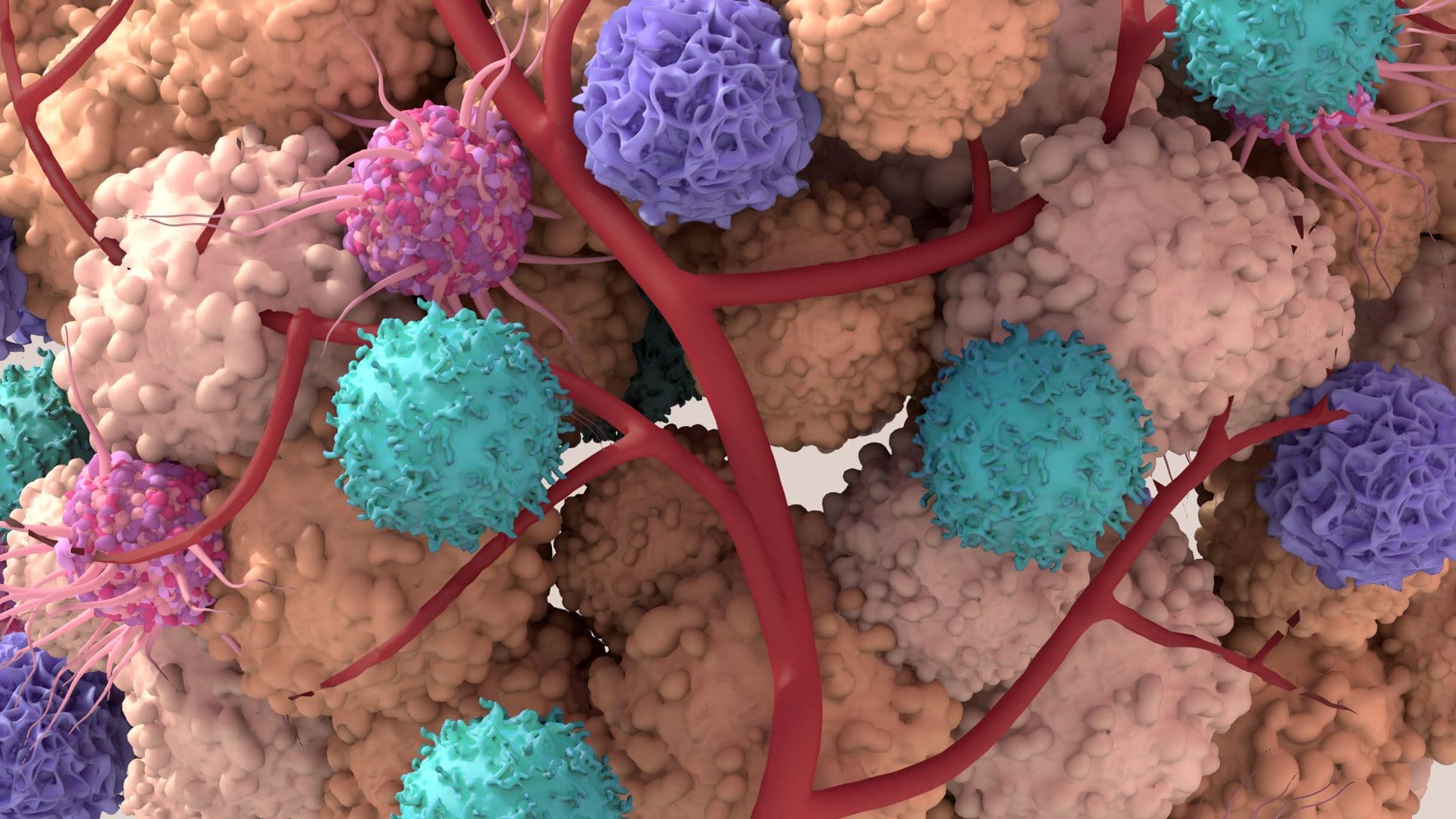 Die Radiotherapie und die Immuntherapie sollen lokale Immunzellen im Tumor aufrütteln