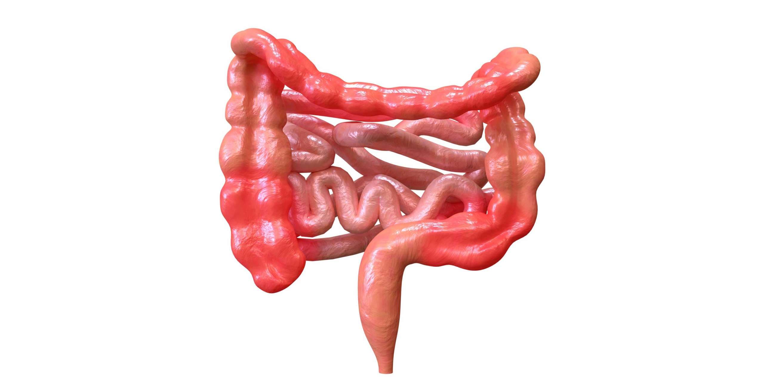 Morbus Crohn ist ein Syndrom, das das Verdauungssystem betrifft. Seine Symptome sind Bauchschmerzen in Verbindung mit Durchfall, Fieber, Gewichtsverlust und Schwäche