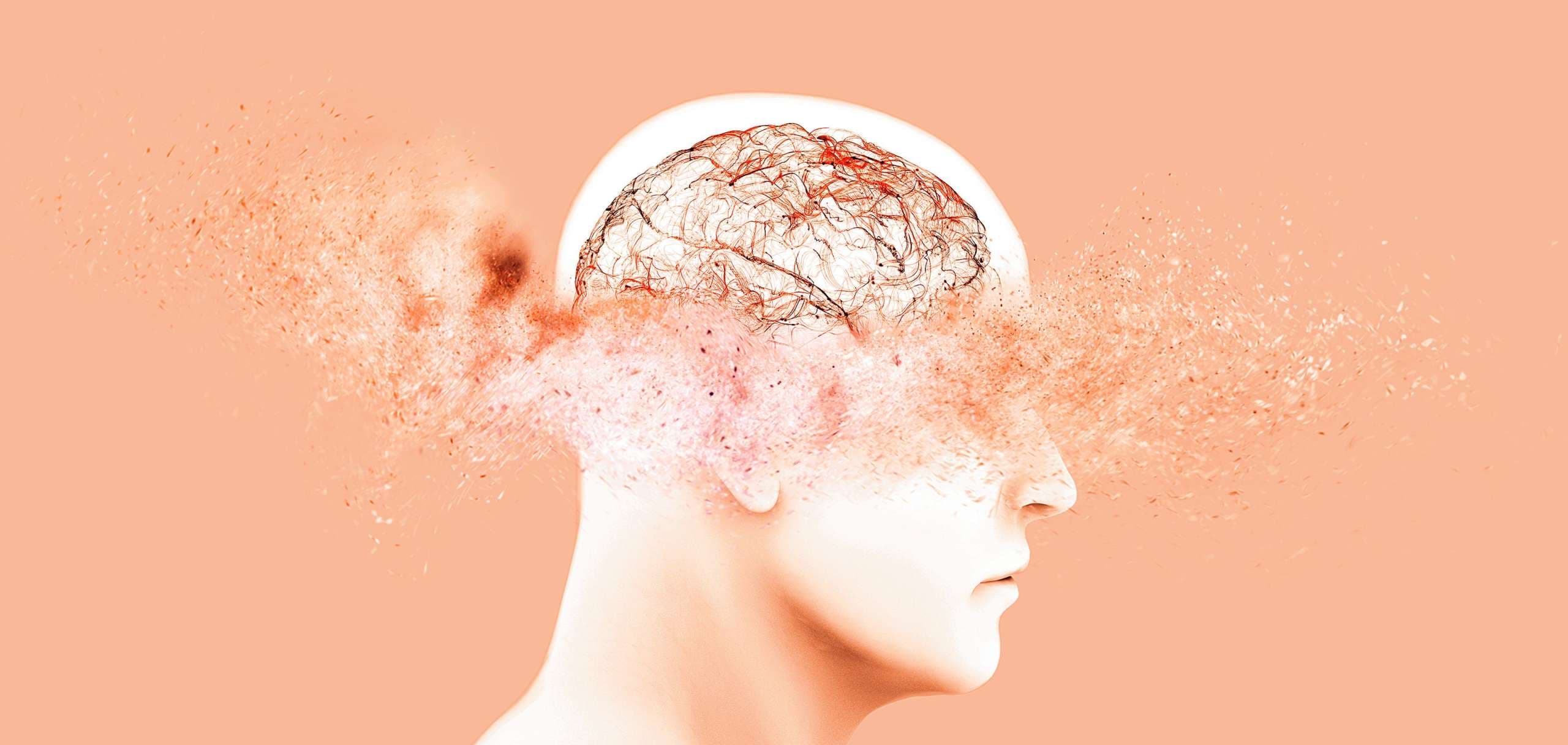 Gedächtnislücken, Dinge vergessen, degenerative Erkrankungen. Gehirnprobleme. Parkinson und alzheimer krankheit. Psychische Gesundheit.