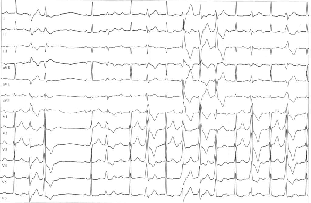 EKG-der-Familie2