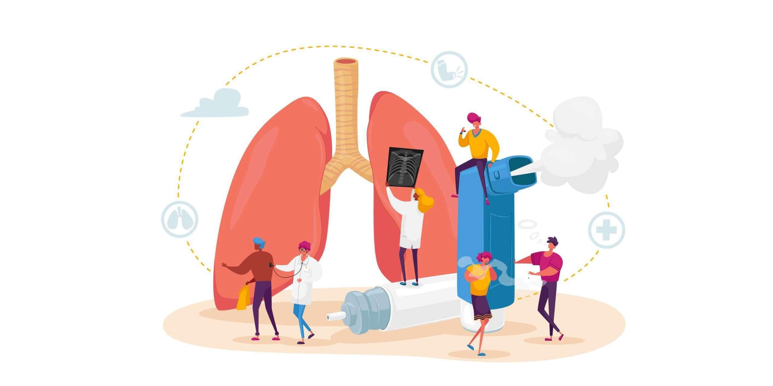 Pneumologie und Asthmaerkrankungen. Winzige Charaktere bei riesigen Lungen und Inhalatoren, Untersuchung und Behandlung des Atmungssystems