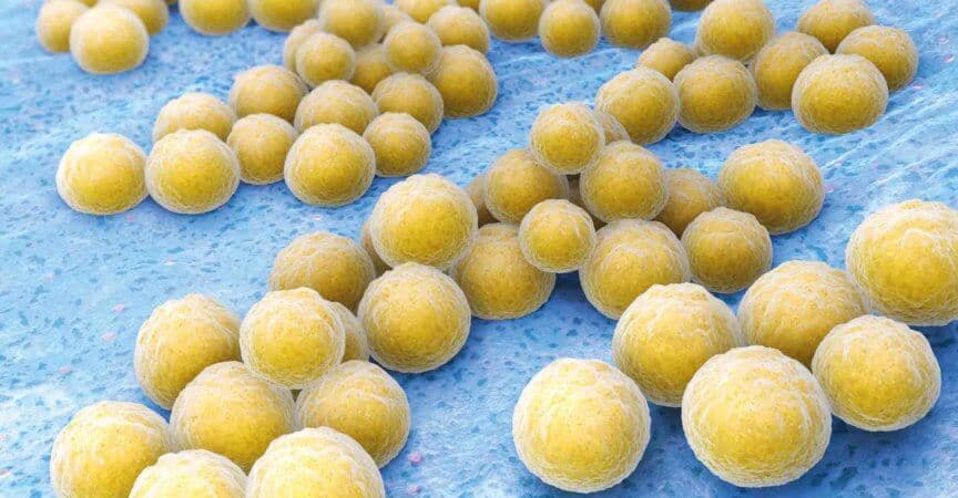 Staphylococcus aureus